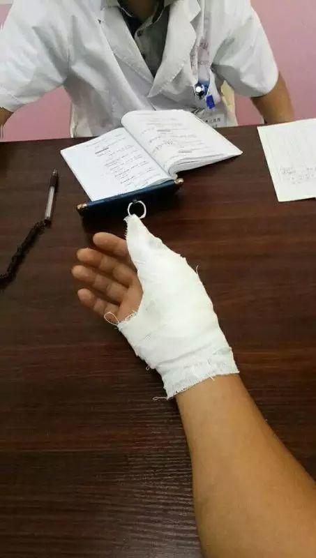 岳阳一名协警托举受伤司机50分钟致手腕脱臼