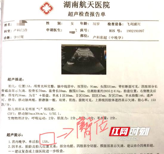 湖南航天医院成功为一名二胎孕妇接生