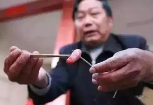 那鸡便一拐一瘸地跑开了。不用消炎、缝合,前后不到几分钟,绝对不留后遗症。