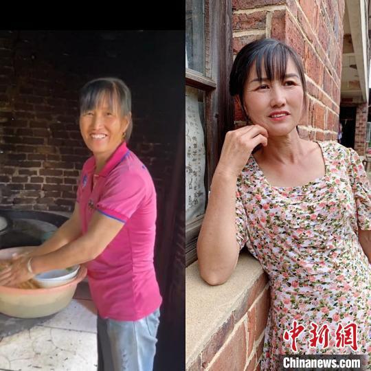 "   长时间在外劳作,村里妇女的脸,脖子和手臂等暴露在外的部位皮肤都