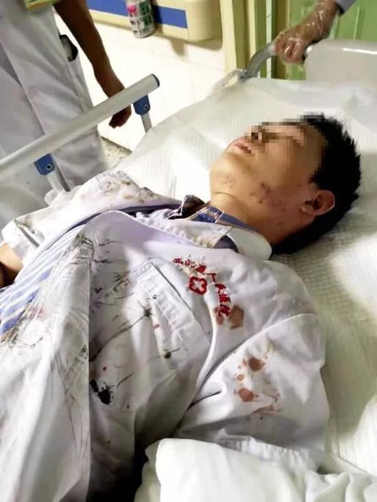 △刘正强在救人时被撞,白大褂鲜血点点 ,被送往医院抢救。