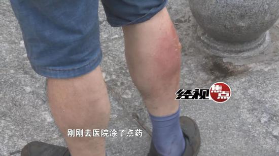 长沙步行街一门店煤气罐起火 工人徒手搬出