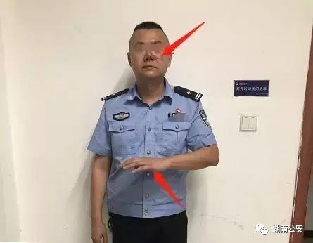 ▲受伤民警