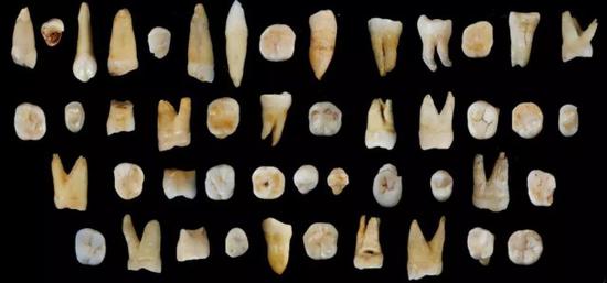 （道县福岩洞遗址出土的现代智人牙齿化石。）