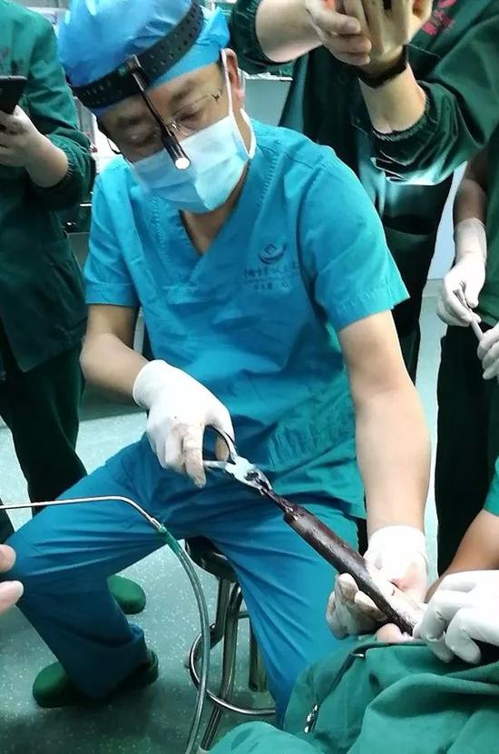 老人口中出血_手出血图片