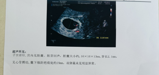 上图为患者夫妇在当地进行B超检查