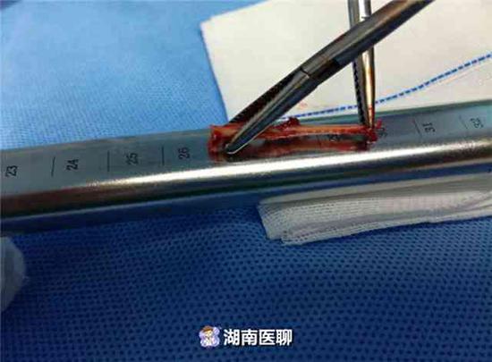 (取出的鱼骨)
