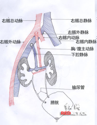 传统手术方法。