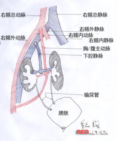 传统手术方法。