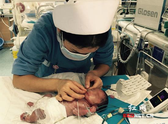 在长沙市中心医院新生儿科，1年多时间就接受救治了52个“袖珍宝宝”