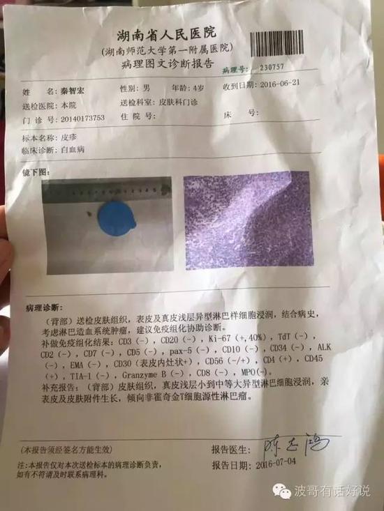 在湖南省人民医院的检查结果（为确诊，写的是“倾向”）