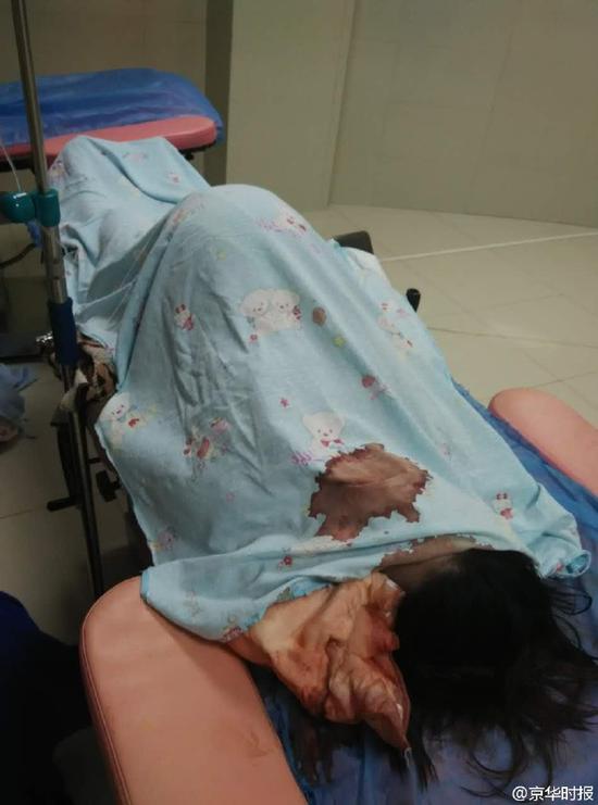 常德一孕妇打无痛分娩针后死亡
