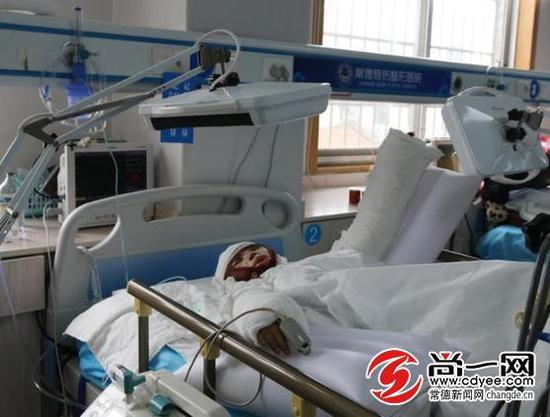 9岁的李颖正躺在常德烧伤整形医院重症病床上,身体被裹上厚厚的纱布,动弹不得 尚一网记者 王浪 摄