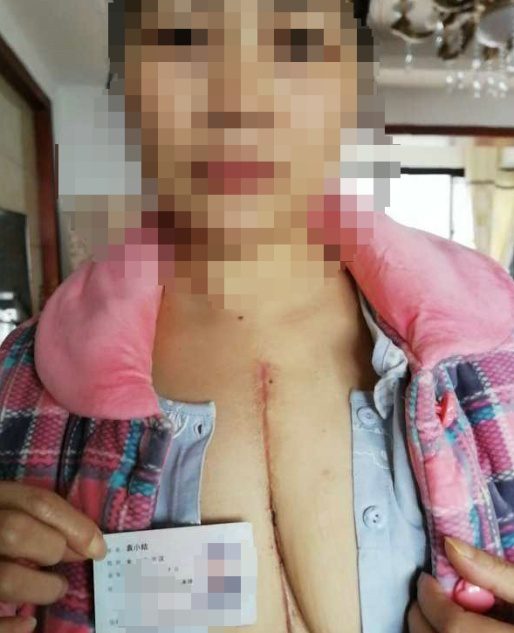 疾病无忧 富德有爱——富德生命人寿株洲中支快速理赔11万元