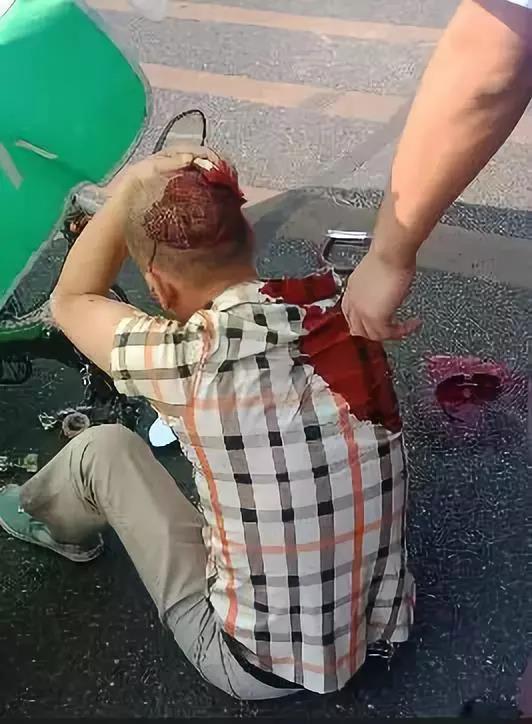 好心市民拿出纱布帮伤者止血