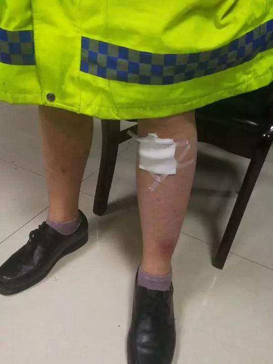 英勇辅警奋不顾身，光荣负伤