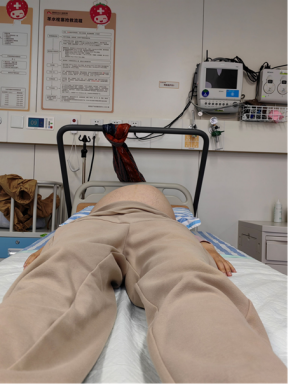 处理前，明显“侧拱”