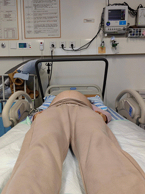 处理后，回归正位