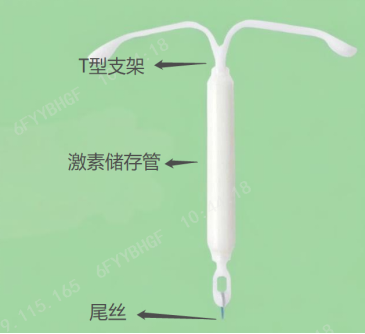 图:曼月乐环