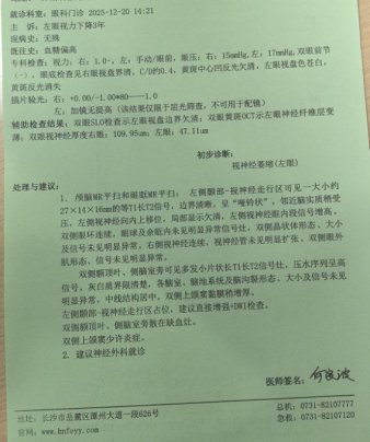 左眼视力悄降3年，一查竟是视神经萎缩！这类信号别忽视