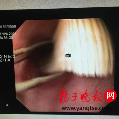 牙刷被取出。