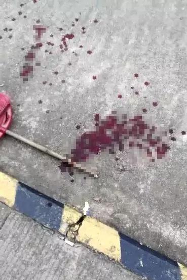 地上的血迹