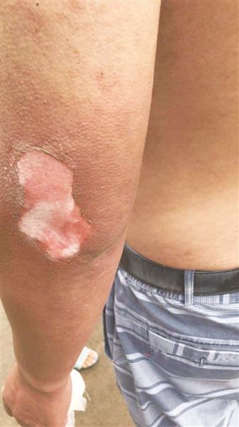 路人见办公楼着火冲进火场救人 警方申报见义勇为