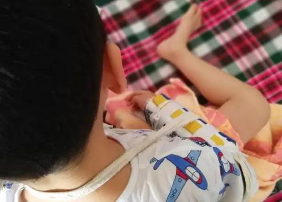 小孩3A景区摔骨折 家长打景区服务电话求助竟是空号