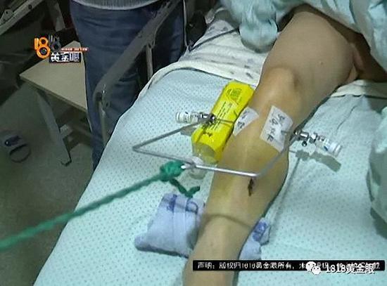 22岁小伙家中上吊自杀 前一天曾开车撞伤8旬老人