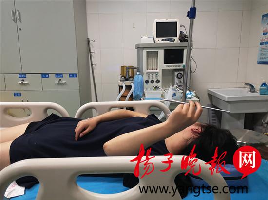 想催吐不锈钢筷却不慎滑进食道 多次模拟手术终取出