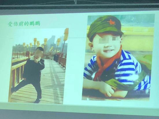 继母虐童案庭审:继母承认电线捆竹棍打 辩称管教