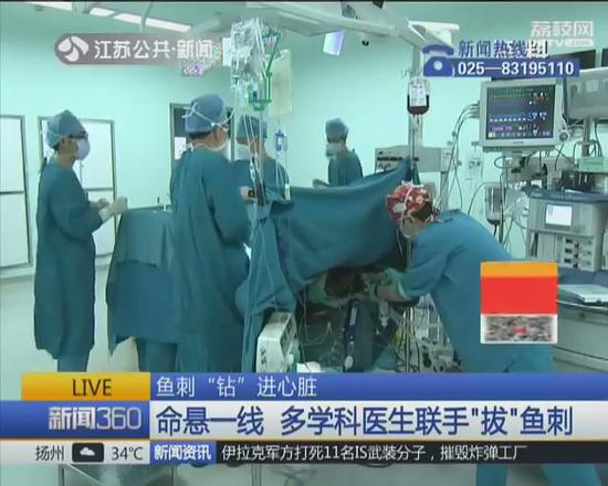 【命悬一线 多学科医生联手“拔”鱼刺】