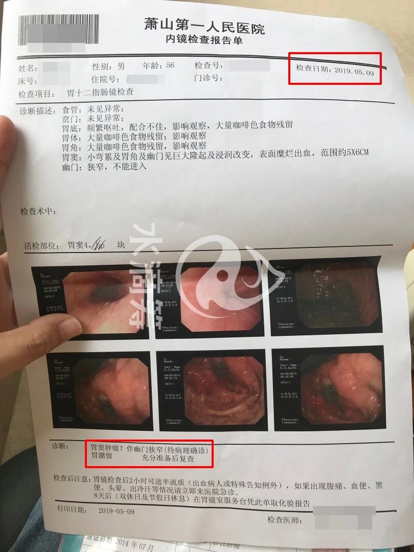 筹款人在筹款页面上贴出的萧山第一人民医院出具的内镜检查报告单显示,患者并未被确诊胃癌。