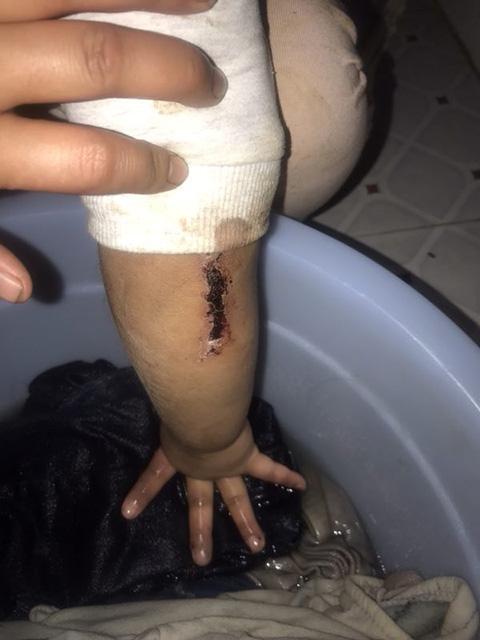 4岁女童被绑锁家中疑遭虐待 警方已介入调查