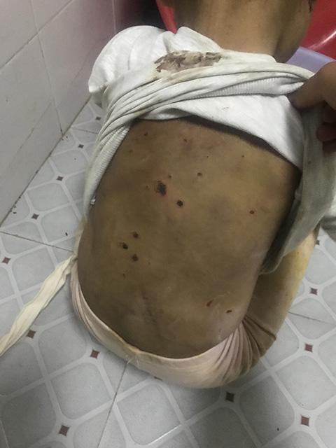 4岁女童被绑锁家中疑遭虐待 警方已介入调查