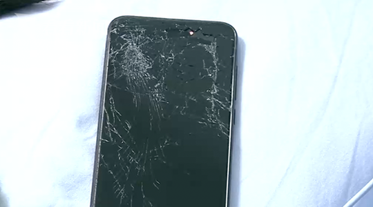 女孩为庆祝考上大学旅游 自拍摔成重伤爆裂性骨折