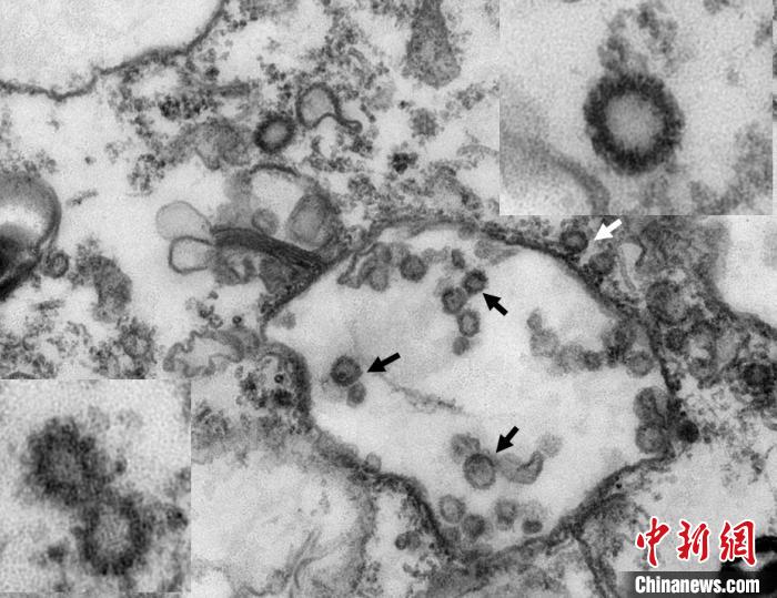 从穿山甲分离的新型冠状病毒电镜照片。　受访者提供