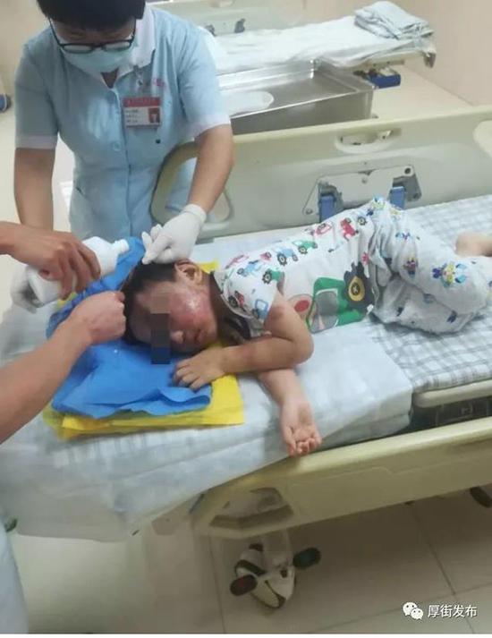 4岁男童遭单亲母亲虐待 全身多处受伤生殖器被打肿