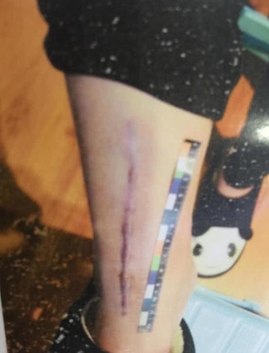 17岁女生不堪同学侮辱殴打跳楼摔残 6名学生被判担七成责