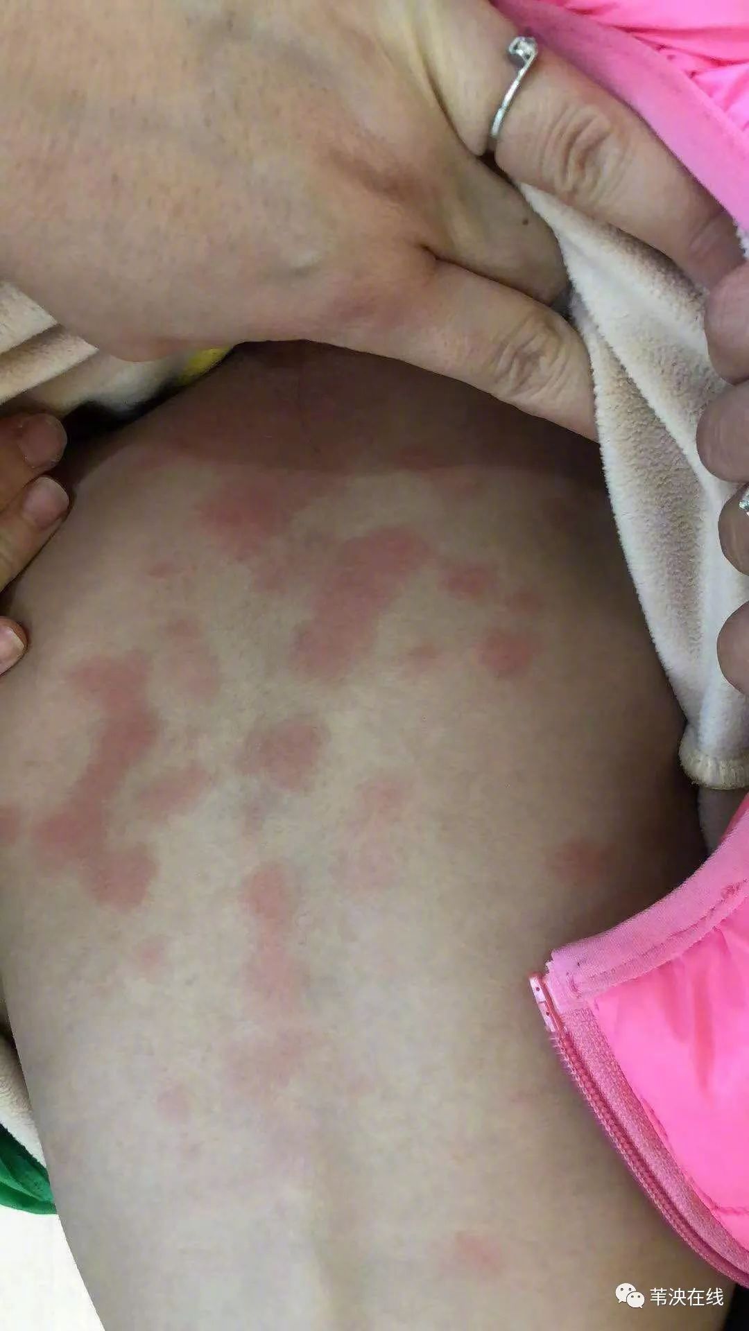 网传如东一早教机构多名幼儿出现身体问题 官方介入调查