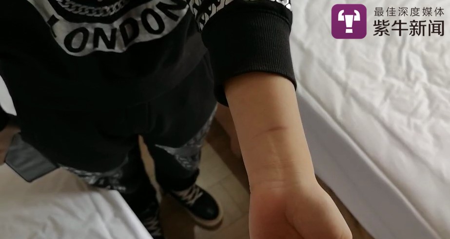 女孩一次整容13项 鼻子歪了 腿粗细不一要自杀