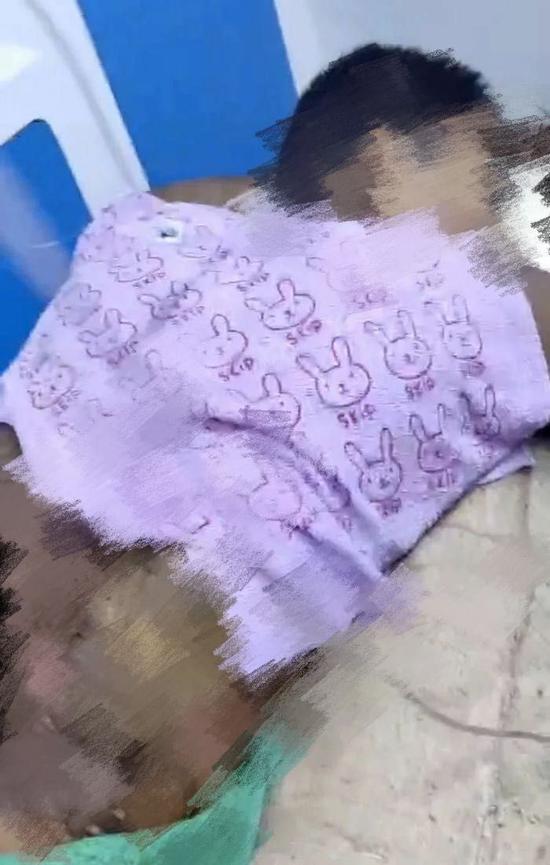 ##15岁少年误碰高压线全身大面积烧伤，单身母亲求助