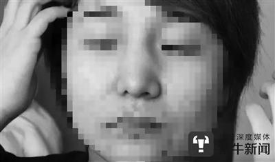 郭小姐鼻梁左右两侧并不对称。