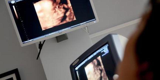 孕检显示正常宝宝长大后却少个肾 医院人道补偿1.5万