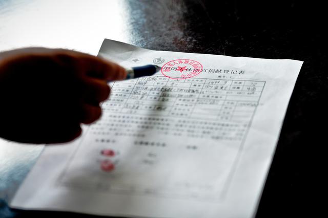 去年我国完成1.6万个大器官捐献 全球排名第3