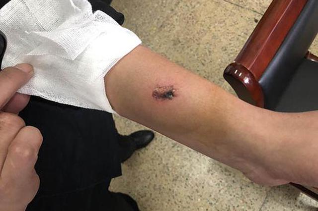 南京保安抱住轻生患者被咬下一块肉:只想着不能松手