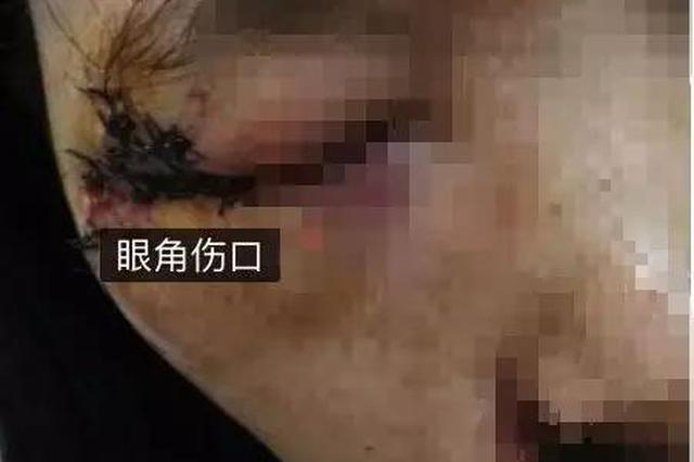 外卖员撞女子致其眼角破裂 称撞死和我无关就200块