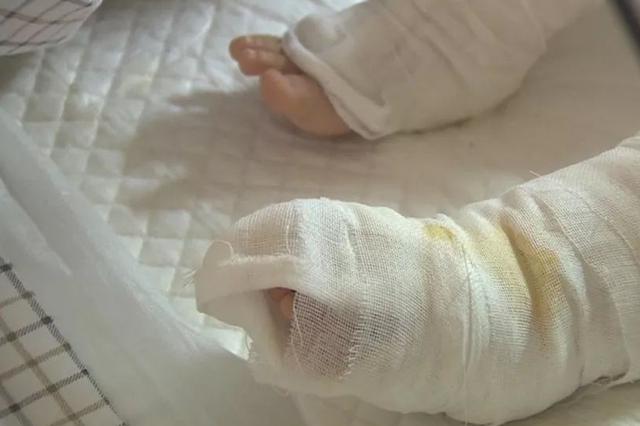 4岁男孩被烫伤收到十余万善款 妈妈感动：别再捐了