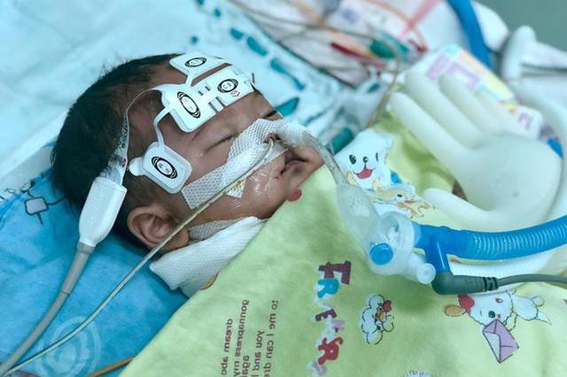 2岁姐姐给2个月弟弟喂了一口洗衣液后 弟弟昏迷不醒