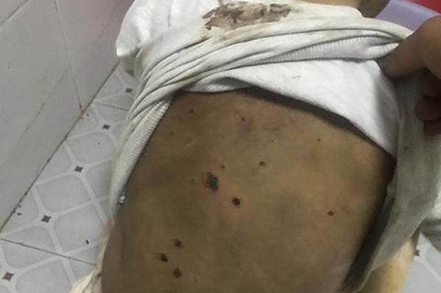 4岁女童被绑锁家中疑遭虐待 警方已介入调查